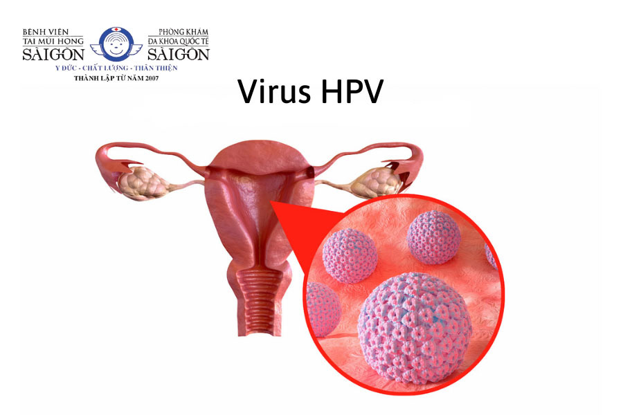Dấu hiệu ung thư cổ tử cung do HPV