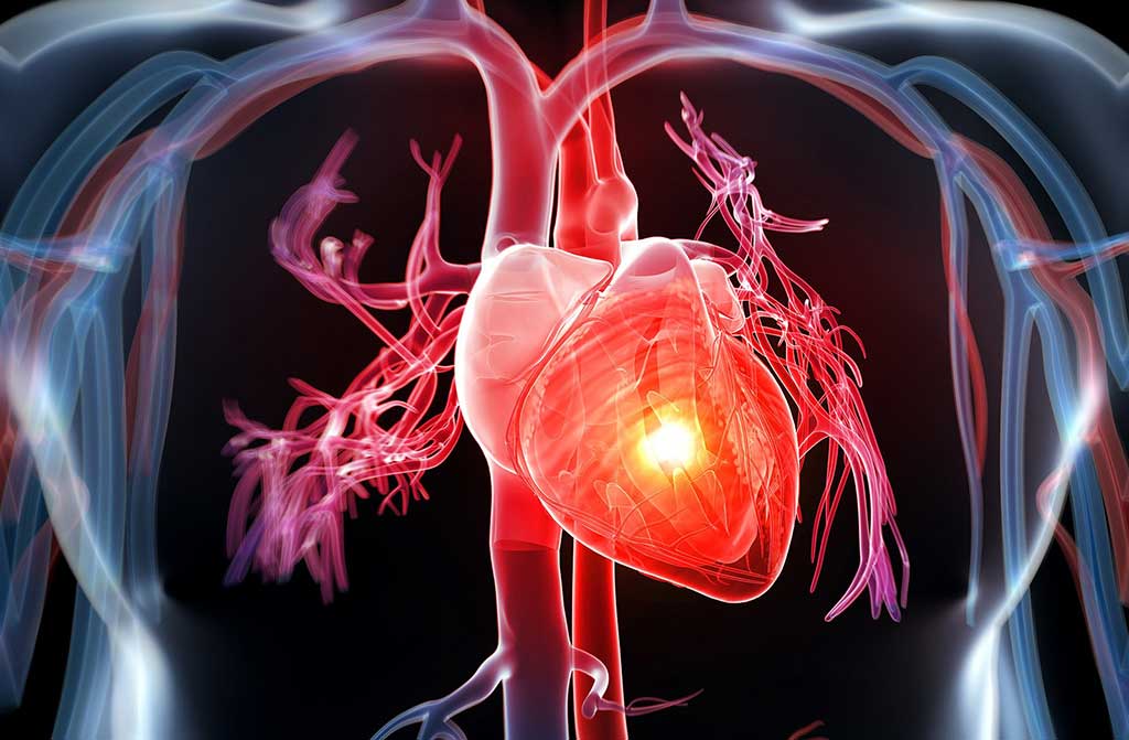 Các yếu tố nguy cơ bệnh tim mạch