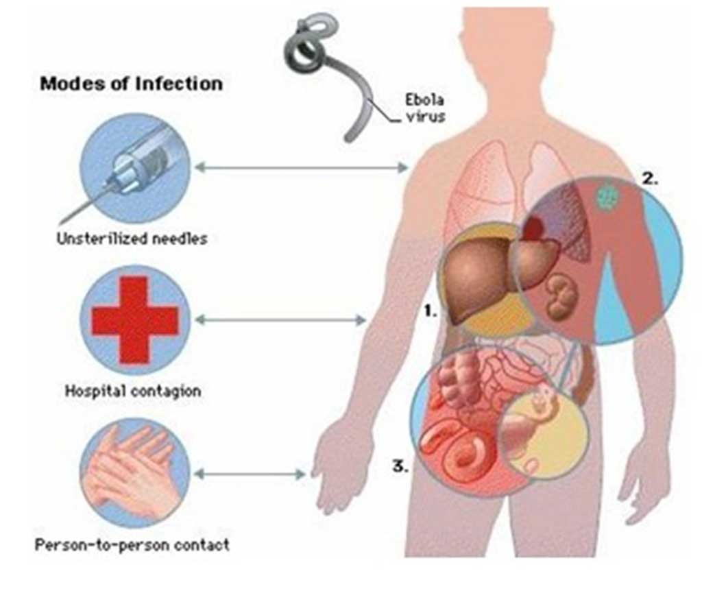 Các phương thức lây nhiễm virus Ebola