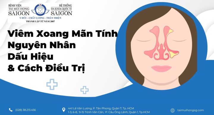 Viêm Xoang Mãn Tính