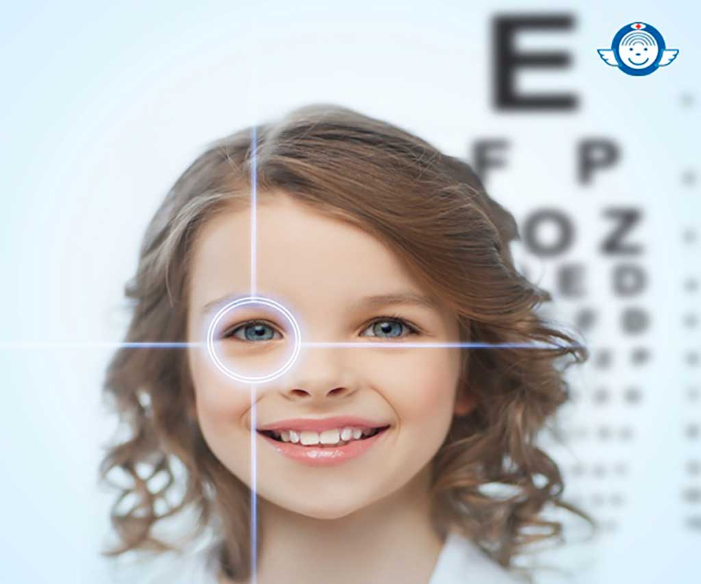 Phân biệt các loại tật khúc xạ ở mắt