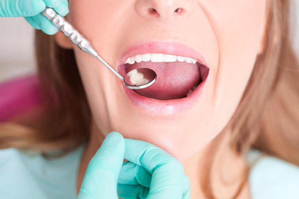 mắc bệnh răng miệng có thể xâm nhập thông qua đường máu