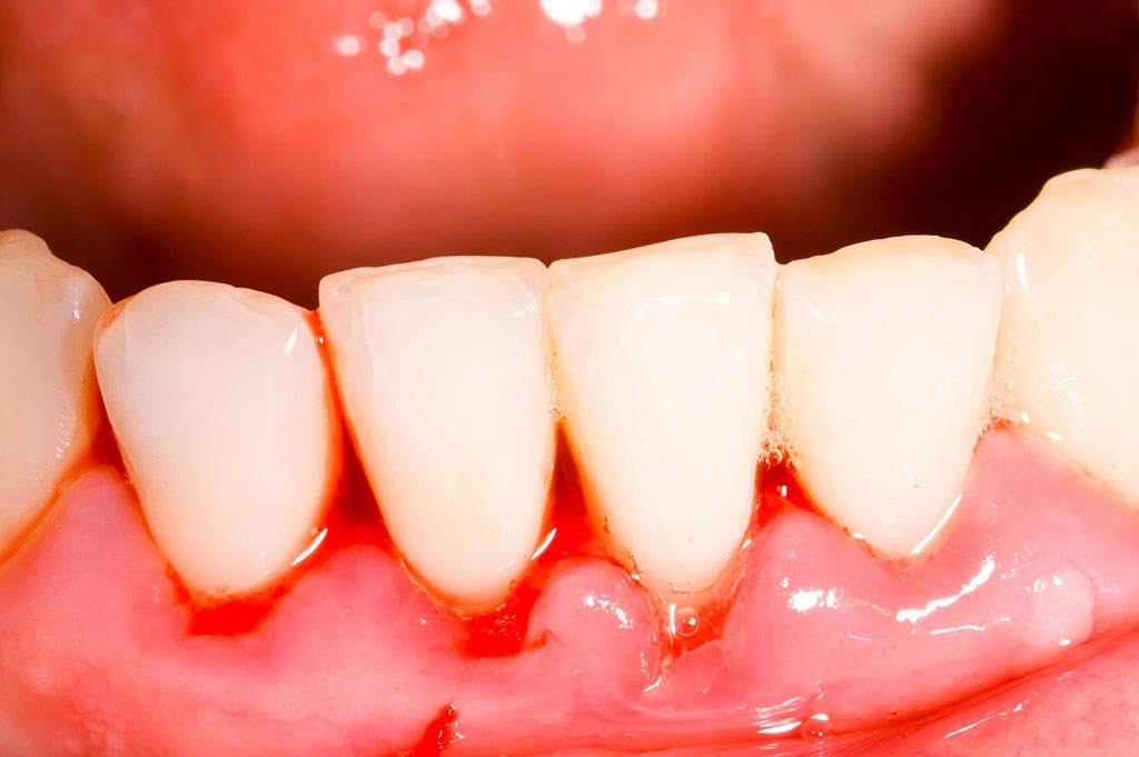 5 triệu chứng về răng miệng bất thường - Phòng Khám Đa Khoa Quốc Tế Sài Gòn 
