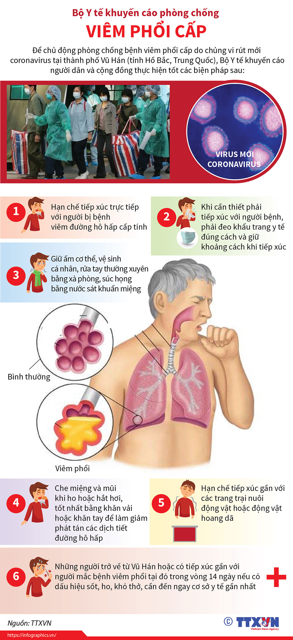 Bộ Y tế khuyến cáo phòng chống viêm phổi cấp - Bệnh viện Tai Mũi Họng Sài Gòn