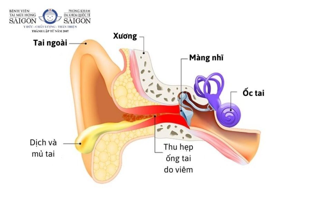 dấu hiệu chảy máu tai