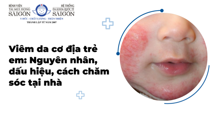 Viêm da cơ địa trẻ em