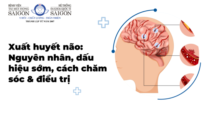 Xuất huyết não
