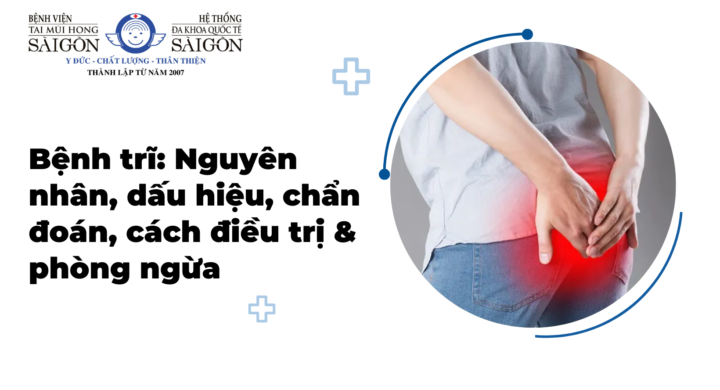 Bệnh trĩ