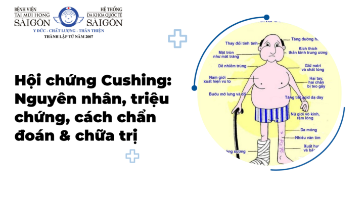 Hội chứng cushing