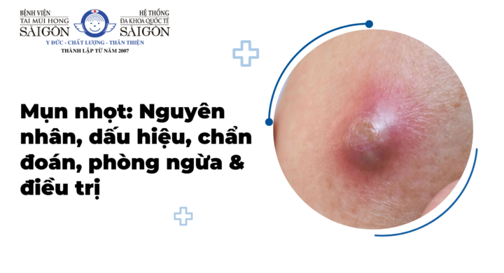 Mụn nhọt