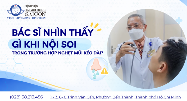 BAC SI NHIN THAY GI KHI NOI SOI TRONG TRUONG HOP NGHET MUI KEO DAI